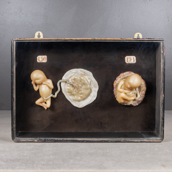 Early 19th c.Medical Teaching Device- Shadowboxed Wax Fetus Models c.1800-1850