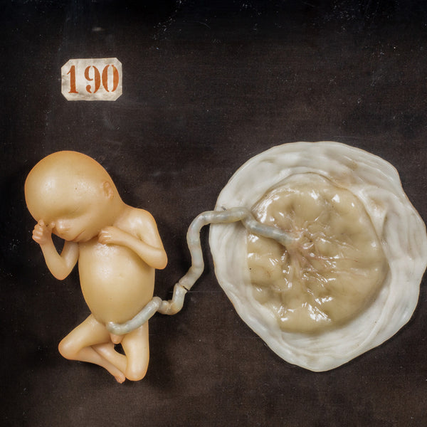 Early 19th c.Medical Teaching Device- Shadowboxed Wax Fetus Models c.1800-1850