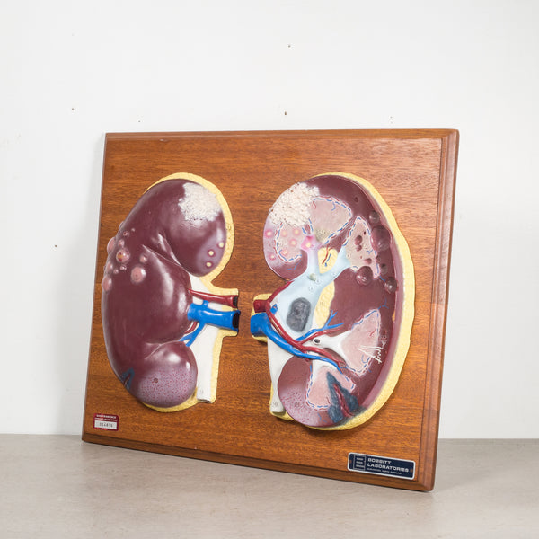 Professional Medical Teaching Display of Human Kidneys c.1950
