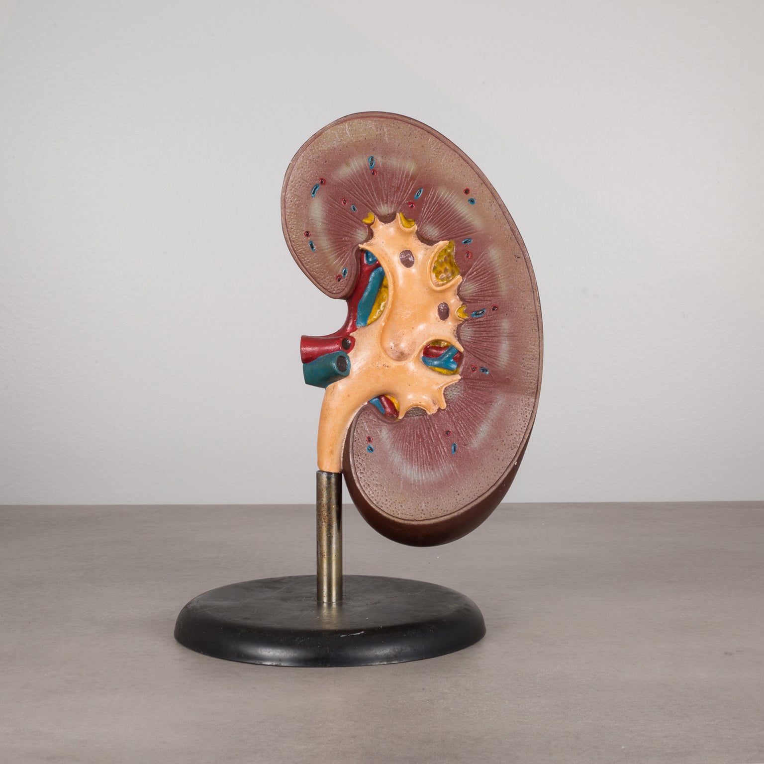 Kidney Display Professional Medical Teaching Display of Human Kidney c.1970 – S16 Home