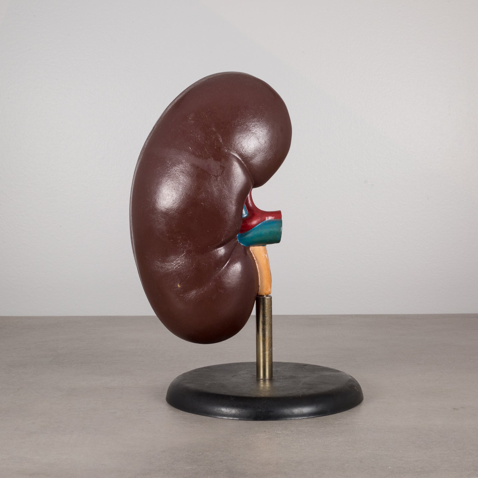 Kidney Display Professional Medical Teaching Display of Human Kidney c.1970 – S16 Home